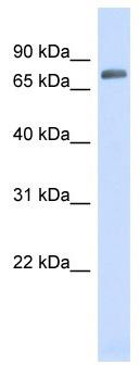 WB Suggested Anti-TRIM41 Antibody Titration: 0.2-1 ug/ml; ELISA Titer: 1:62500; Positive Control: Human Muscle