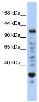 WB Suggested Anti-NFX1 Antibody Titration: 0.2-1 ug/ml; ELISA Titer: 1:62500; Positive Control: Jurkat cell lysate NFX1 is strongly supported by BioGPS gene expression data to be expressed in Human Jurkat cells