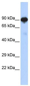 WB Suggested Anti-RFX4 Antibody Titration: 0.2-1 ug/ml; ELISA Titer: 1:312500; Positive Control: Human brain