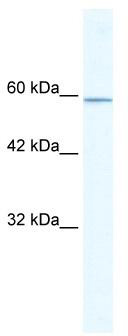 WB Suggested Anti-KLHL5 Antibody Titration: 5.0 ug/ml; ELISA Titer: 1:312500; Positive Control: HepG2 cell lysate