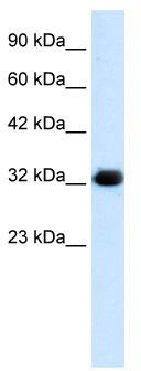 WB Suggested Anti-HS747E2A Antibody Titration: 1.25 ug/ml; ELISA Titer: 1:500; Positive Control: HepG2 cell lysate
