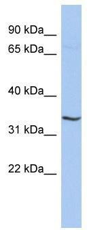 WB Suggested Anti-RNF113B Antibody Titration: 0.2-1 ug/ml; ELISA Titer: 1:12500; Positive Control: ACHN cell lysate
