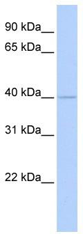 WB Suggested Anti-WDR45L Antibody Titration: 0.2-1 ug/ml; ELISA Titer: 1:62500; Positive Control: MCF7 cell lysate