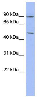 WB Suggested Anti-ZNF569 Antibody Titration: 0.2-1 ug/ml; ELISA Titer: 1:312500; Positive Control: HT1080 cell lysate