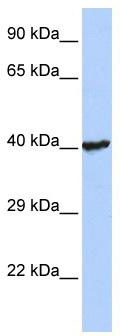 WB Suggested Anti-RNF113B Antibody Titration: 0.2-1 ug/ml; ELISA Titer: 1:62500; Positive Control: Jurkat cell lysate