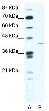 WB Suggested Anti-ZNF568 Antibody Titration: 1.25 ug/ml; ELISA Titer: 1:12500; Positive Control: HepG2 cell lysate