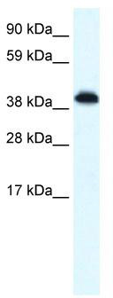 WB Suggested Anti-ZNF568 Antibody Titration: 0.2-1 ug/ml; ELISA Titer: 1:62500; Positive Control: Human brain