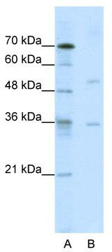 WB Suggested Anti-DIDO1 Antibody Titration: 0.2-1 ug/ml; ELISA Titer: 1:62500; Positive Control: Jurkat cell lysate DIDO1 is strongly supported by BioGPS gene expression data to be expressed in Human Jurkat cells