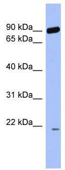 WB Suggested Anti-RNF135 Antibody Titration: 0.2-1 ug/ml; ELISA Titer: 1:62500; Positive Control: COLO205 cell lysate