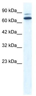 WB Suggested Anti-ZNF57 Antibody Titration: 0.2-1 ug/ml; ELISA Titer: 1:12500; Positive Control: HepG2 cell lysate