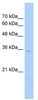 WB Suggested Anti-ZNF547 Antibody Titration: 2.5 ug/ml; Positive Control: Jurkat cell lysate