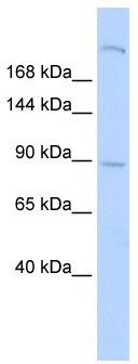 WB Suggested Anti-SHROOM2 Antibody Titration: 0.2-1 ug/ml; ELISA Titer: 1:312500; Positive Control: Human Lung