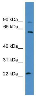 WB Suggested Anti-KCNS1 Antibody Titration: 0.2-1 ug/ml; ELISA Titer: 1:312500; Positive Control: HepG2 cell lysate