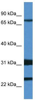 WB Suggested Anti-Kcnd1 Antibody; Titration: 1.0 ug/ml; Positive Control: Mouse Spleen