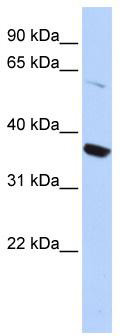 WB Suggested Anti-KCNA10 Antibody Titration: 0.2-1 ug/ml; ELISA Titer: 1:312500; Positive Control: HepG2 cell lysate