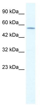WB Suggested Anti-KCNA10 Antibody Titration: 1.25 ug/ml; ELISA Titer: 1:312500; Positive Control: Jurkat cell lysate