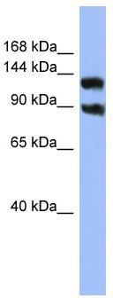 WB Suggested Anti-KCNH3 Antibody Titration: 0.2-1 ug/ml; ELISA Titer: 1:12500; Positive Control: OVCAR-3 cell lysate