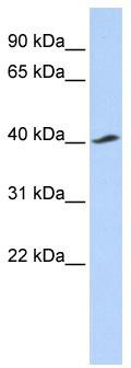 WB Suggested Anti-KCNJ16 Antibody Titration: 0.2-1 ug/ml; ELISA Titer: 1:12500; Positive Control: 721_B cell lysate