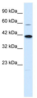 WB Suggested Anti-KCNK13 Antibody Titration: 0.12 ug/ml; ELISA Titer: 1:1562500; Positive Control: Jurkat cell lysate