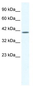 WB Suggested Anti-KCNK13 Antibody Titration: 1.25 ug/ml; ELISA Titer: 1:312500; Positive Control: Jurkat cell lysate