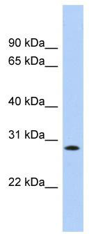 WB Suggested Anti-KCTD17 Antibody Titration: 0.2-1 ug/ml; Positive Control: HepG2 cell lysate