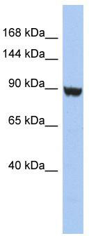 WB Suggested Anti-KCNH6 Antibody Titration: 0.2-1 ug/ml; ELISA Titer: 1:312500; Positive Control: HT1080 cell lysate