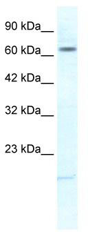 WB Suggested Anti-KCNH6 Antibody Titration: 1.25 ug/ml; ELISA Titer: 1:312500; Positive Control: Jurkat cell lysate
