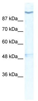 WB Suggested Anti-KCNH6 Antibody Titration: 0.2-1 ug/ml; ELISA Titer: 1:12500; Positive Control: HepG2 cell lysate
