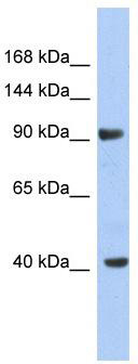 WB Suggested Anti-KCNH6 Antibody Titration: 0.2-1 ug/ml; ELISA Titer: 1:312500; Positive Control: NCI-H226 cell lysate KCNH6 is strongly supported by BioGPS gene expression data to be expressed in NCI-H226