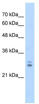 WB Suggested Anti-KCTD11 Antibody Titration: 1.25 ug/ml; Positive Control: Jurkat cell lysate