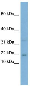 WB Suggested Anti-CEBPG Antibody Titration: 0.2-1 ug/ml; Positive Control: PANC1 cell lysate CEBPG is supported by BioGPS gene expression data to be expressed in PANC1
