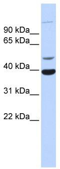 WB Suggested Anti-ZNF124 Antibody Titration: 0.2-1 ug/ml; ELISA Titer: 1:312500; Positive Control: Human heart