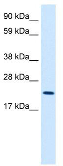 WB Suggested Anti-MYCL1 Antibody Titration: 2.5 ug/ml; ELISA Titer: 1:312500; Positive Control: Human kidney