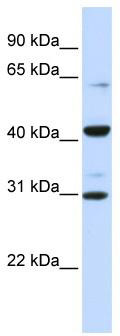 WB Suggested Anti-ZNF193 Antibody Titration: 0.2-1 ug/ml; ELISA Titer: 1:312500; Positive Control: Human brain