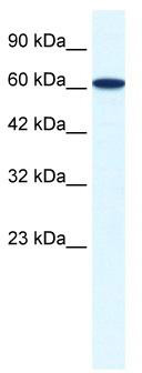 WB Suggested Anti-ZNF266 Antibody Titration: 0.2-1 ug/ml; ELISA Titer: 1:1562500; Positive Control: HepG2 cell lysate