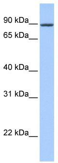 WB Suggested Anti-ZNF16 Antibody Titration: 0.2-1 ug/ml; ELISA Titer: 1:312500; Positive Control: Human Muscle