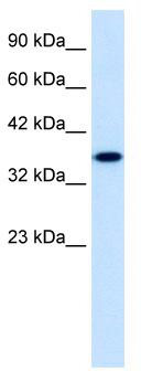 WB Suggested Anti-ZNF75 Antibody Titration: 1.25 ug/ml; ELISA Titer: 1:312500; Positive Control: HepG2 cell lysate