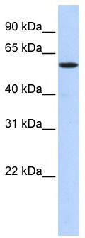 WB Suggested Anti-NUFIP1 Antibody Titration: 0.2-1 ug/ml; ELISA Titer: 1:312500; Positive Control: Transfected 293T