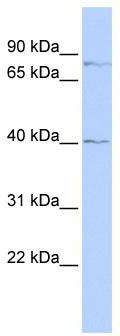 WB Suggested Anti-ZNF214 Antibody Titration: 0.2-1 ug/ml; ELISA Titer: 1:312500; Positive Control: Jurkat cell lysate