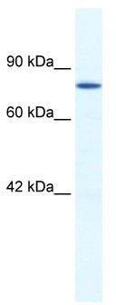 WB Suggested Anti-ZNF214 Antibody Titration: 1.25 ug/ml; ELISA Titer: 1:1562500; Positive Control: Jurkat cell lysate