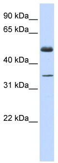 WB Suggested Anti-ZNF223 Antibody Titration: 0.2-1 ug/ml; ELISA Titer: 1:62500; Positive Control: Human Muscle