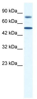 WB Suggested Anti-ZNF223 Antibody Titration: 0.2-1 ug/ml; ELISA Titer: 1:12500; Positive Control: Jurkat cell lysate
