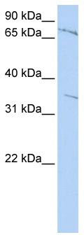 WB Suggested Anti-ZNF224 Antibody Titration: 0.2-1 ug/ml; ELISA Titer: 1:12500; Positive Control: Jurkat cell lysateThere is BioGPS gene expression data showing that ZNF224 is expressed in Jurkat