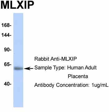 Gel: 12%SDS-PAGE<br>Lysate: 40 μg<br>Lane 1-2: Human left kidney tissue and Human fetal liver tissue lysates<br>Primary antibody: TA369636 (GAR1 Antibody) at dilution 1/250<br>Secondary antibody: Goat anti rabbit IgG at 1/8000 dilution<br>Exposure time: 2 minutes