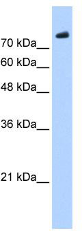WB Suggested Anti-PHF20 Antibody Titration: 0.2-1 ug/ml; ELISA Titer: 1:2500; Positive Control: Jurkat cell lysate