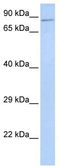 WB Suggested Anti-ZNF226 Antibody Titration: 0.2-1 ug/ml; ELISA Titer: 1:1562500; Positive Control: 293T cell lysateZNF226 is supported by BioGPS gene expression data to be expressed in HEK293T