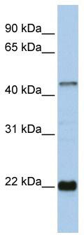 WB Suggested Anti-ZNF581 Antibody Titration: 0.2-1 ug/ml; ELISA Titer: 1:62500; Positive Control: 721_B cell lysate