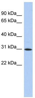 WB Suggested Anti-ZNF771 Antibody Titration: 0.2-1 ug/ml; ELISA Titer: 1:1562500; Positive Control: Human Thymus
