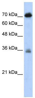 WB Suggested Anti-NKRF Antibody Titration: 0.2-1 ug/ml; ELISA Titer: 1:62500; Positive Control: Transfected 293T