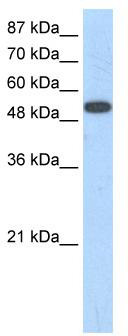 WB Suggested Anti-ZNF416 Antibody Titration: 1.25 ug/ml; ELISA Titer: 1:1562500; Positive Control: 293T cell lysate
